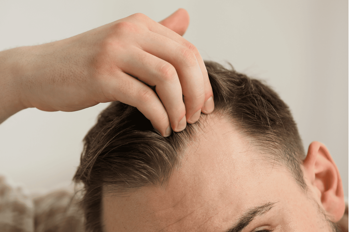 Featured image for “Revive Your Hairline with the Power of  ARTAS® iX”